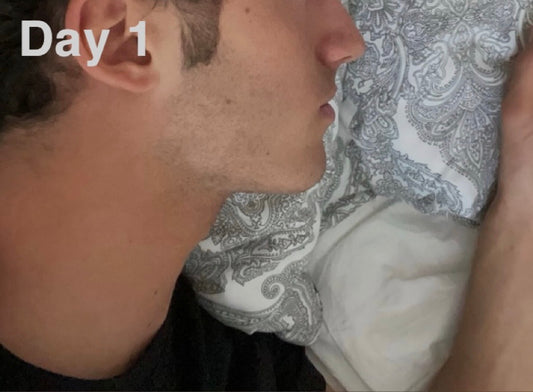 ELEVATE™ Jawline Trainer